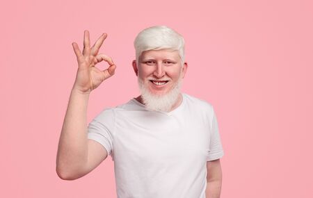 Smiling albino man with OK gestureの写真素材