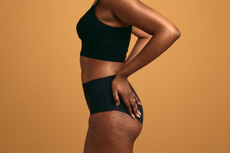 Crop black woman with stretch marks on bodyの写真素材