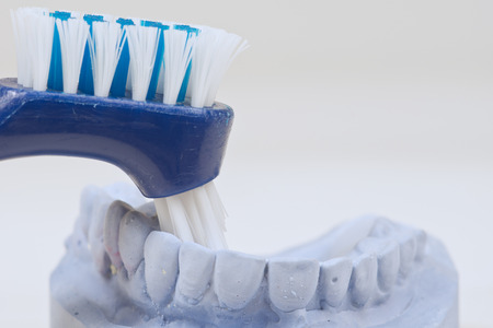 Dental mould on a white backgroundの写真素材