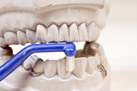 Dental mould on a white background