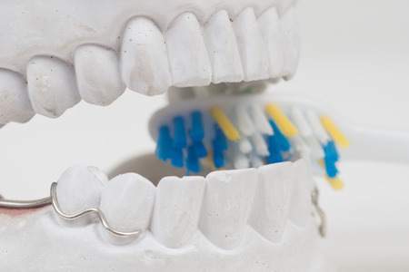 Dental mould on a white backgroundの写真素材