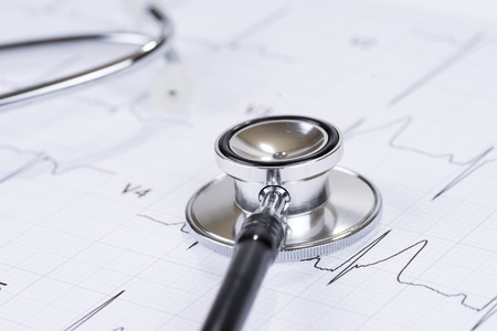 Stethoscope on the paper electrocardiogram. Medical examination