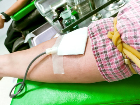 Image of syringe and the hose was pierced on the arm of blood donor. Blood donation is another contribution to other patients' lives. And in Thailand is considered a merit.の写真素材