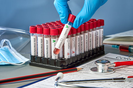 A test tube in your hand with negative blood samples for COVID-19 next to the coronovirus test form. Blood testing for the presence of antibodies to the causative agent of a new coronavirus infectionの写真素材