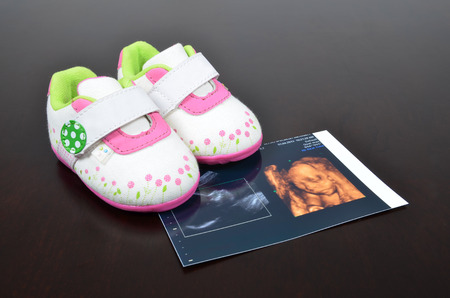 Baby shoe with ultrasound imagesの写真素材