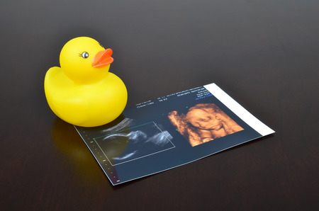 Rubber duck baby toy with ultrasound images