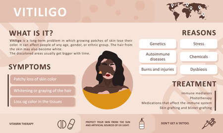 Infographics of vitiligo. Causes of the disease. Abstract african woman silhouette. Vector concept to support people living with vitiligo and to build awareness about chronic skin disorder. Self care.