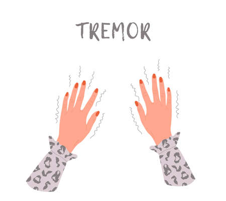 Tremor hands. Parkinson disease. Female arms with nails. Physiological stress symptoms. Vector illustration in flat cartoon styleのイラスト素材