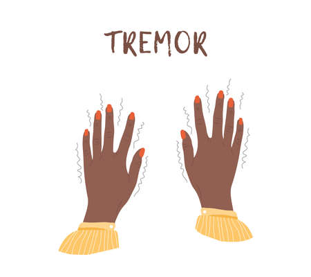 Tremor hands. Parkinson disease. Female arms with nails. Physiological stress symptoms. Vector illustration in flat cartoon styleのイラスト素材