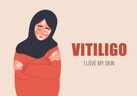 Muslim woman with vitiligo. Self care and self love. World vitiligo day. Skin disease. Girl with hijab hugging herself. Vector illustration in flat cartoon styleのイラスト素材
