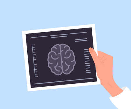 MRI scan. Female hand holding result of Magnetic resonance imaging. Brain diseases. Health care and treatment concept. Vector illustration in flat cartoon styleのイラスト素材