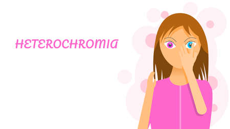 Flat Girl Woman Character Covers His Face With His Hand With Different Colors Eyes Disease Heterochromia Conceptのイラスト素材