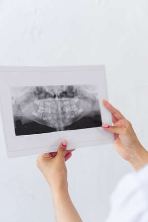 Concept dentistry. in girls, womans hands black and white picture. From behind of Young woman dentist with black hair looks at snapshot of teeth.の写真素材