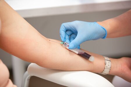 Blood collection, nurse taking blood from a vein, healtcare and medical conceptの写真素材