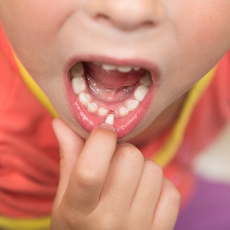 Child points his finger to the loose tooth.