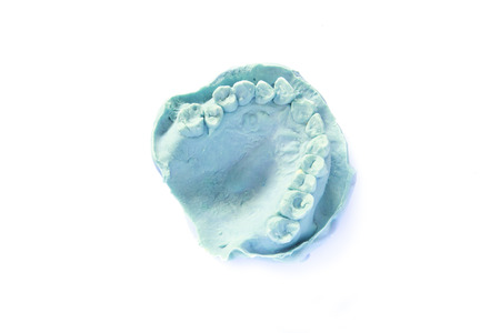 dental impression model on white background - isolatedの写真素材