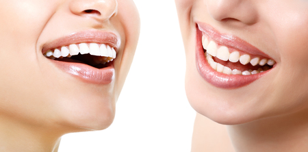 Beautiful wide smile of young fresh women with great healthy white teeth, isolated over white background. Smiling happy women. Laughing female mouth. Healthy beautiful smiles. Teeth health, whitening, prosthetics and careの写真素材