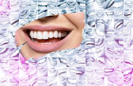 Conceptual background makes of set of laughing human faces with great teeth and detail of young...