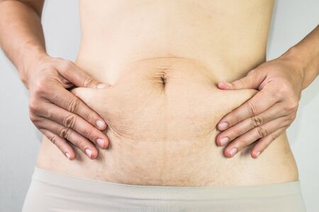 Abdominal scar marked pattern woman with warm white under wear