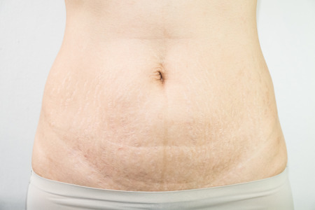 Abdominal pattern with underwearの写真素材