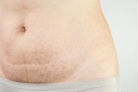 woman belly fat patternの写真素材
