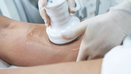 Doctor cosmetologist applies a transparent gel to the patients legsの写真素材