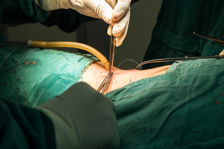 suture woundの写真素材