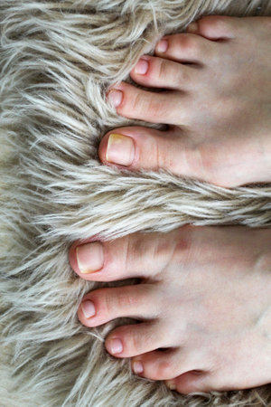 Close-up of human feet with natural toenails on a fluffy carpet, showing minor nail discoloration on...