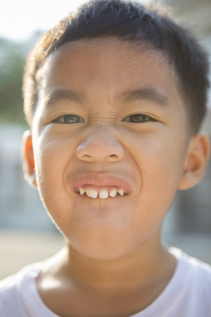 close up face of asian children showing milk toothの写真素材