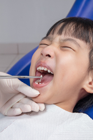 Asian Chinese little girl lying down for tooth extraction at dental clinicの写真素材