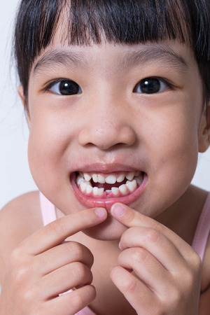 Asian Chinese little girl showing her missing tooth in isolated white backgroundの写真素材