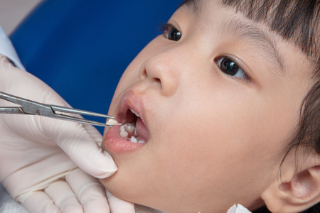 Asian Chinese little girl lying down for tooth extraction at dental clinicの写真素材