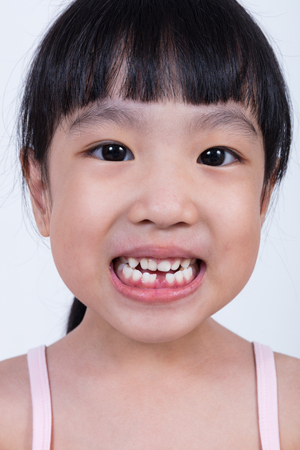 Asian Chinese little girl showing her missing tooth in isolated white backgroundの写真素材