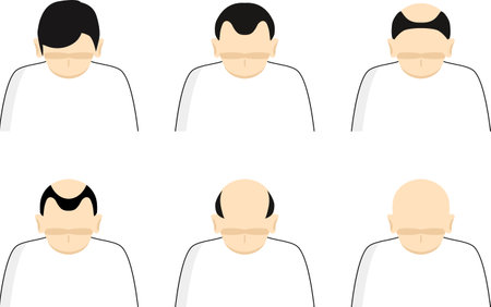 Thinning Hair Setのイラスト素材