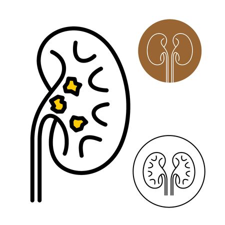 Kidney beans icon with stones disease inside. Kidneys logo. Adjustable stroke width.のイラスト素材