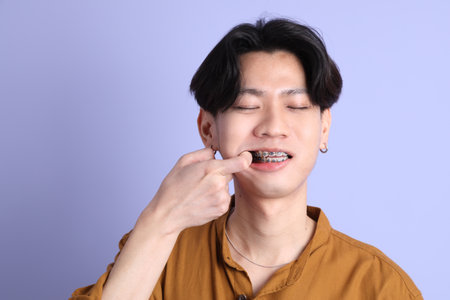 The Adult east Asian man with braces standing on the blue background.の写真素材