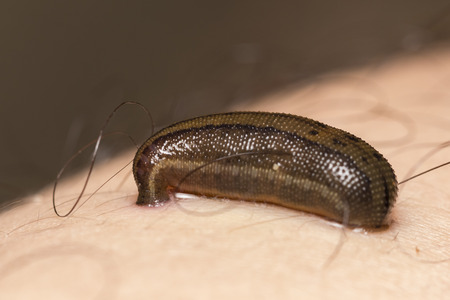 the blood-sucking leech tucks on the human skin in  tropical rain forest.の写真素材
