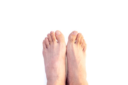 Both bare feet aligned and protruded forward