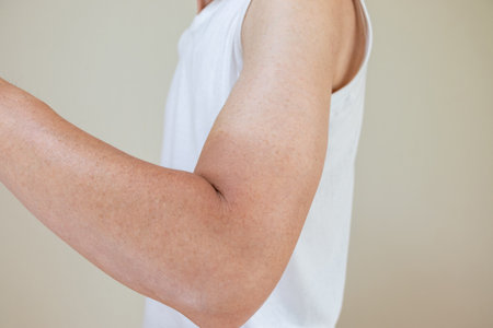 Man's arm with sunburn marks