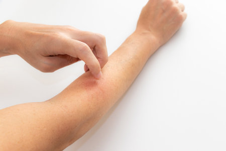 Scratch the area where the insect bites are with a finger