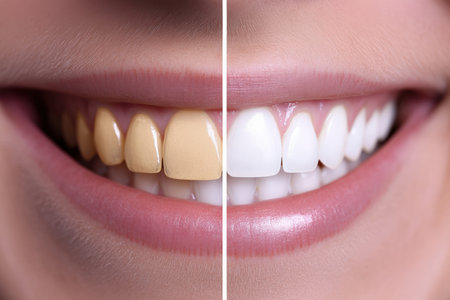 A bright smile with sparkling white teeth after a professional whitening session. Before and after.の写真素材