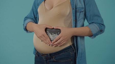 A pregnant woman holds an ultrasound scan, near her stomach, with her hands folded in the shape of a heart. Bloated belly of a pregnant woman in the studio on a blue background close up.の写真素材