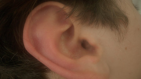 Male right ear. The part of the body responsible for hearing and perception of sounds. The problem...