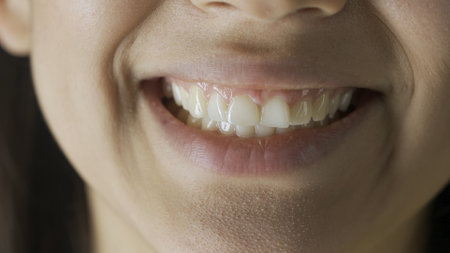 Concept of cosmetic skin care services. Macro shot of womans face. Lips of Asian young woman with...