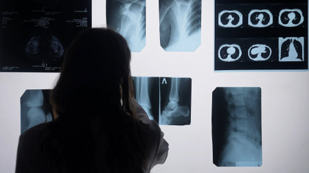 Doctor analyzing X Ray images for medical diagnosisの写真素材