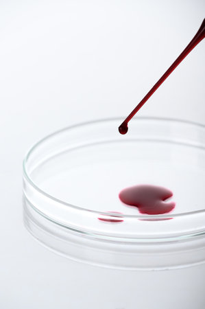 Close-up of pipette drop blood sample or red liquid on petri dish in the medical laboratory- analyzes and diagnostics concept- on white backgroundの写真素材