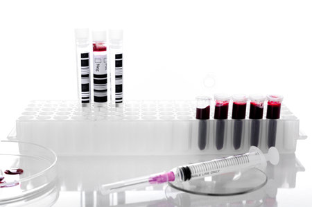Blood sample tube or red liquid in the rack for analysis in the laboratory background- biochemistry- molecular biology- genetics and clinical chemistry conceptsの写真素材
