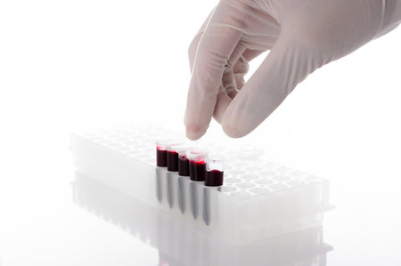 Hand wearing glove taking a blood sample tube or red liquid from a rack in the laboratory- on white backgroundの写真素材