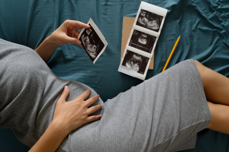 High angle shot of a pregnant woman lie down looking at a sonogram or ultrasonography picture while touching her belly in bedroomの写真素材