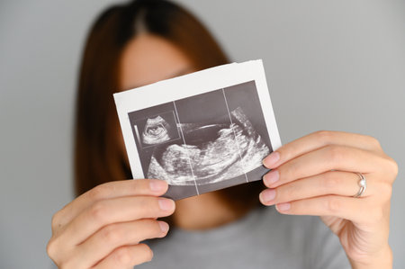 Pregnant Asian woman holding and showing sonogram or ultrasonography picture of her unborn babyの写真素材